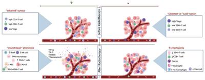 The current understanding of the immune landscape relative to radiotherapy across tumor types